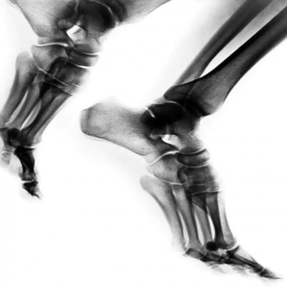 90% of workers report issues with their feet